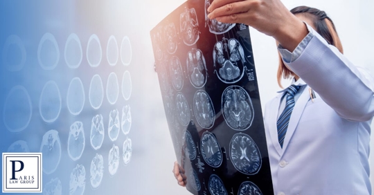 doctor looking at head scans